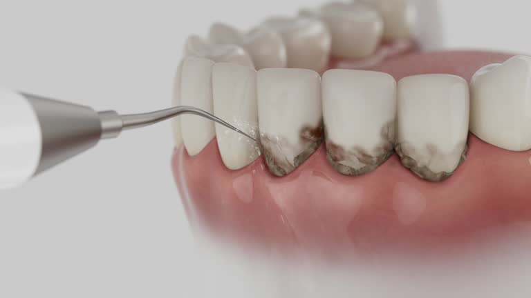 Trusted Tooth Extraction service in Garden Ridge, TX - Dentist Open Now